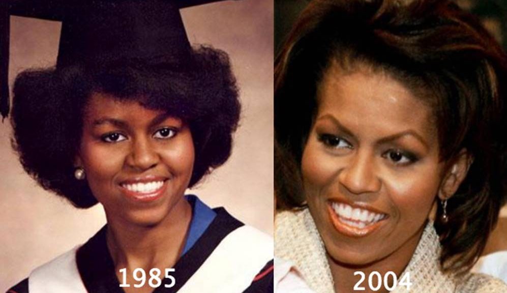 Michelle Obama’s Before and After